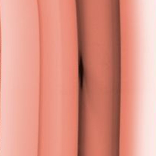 Roségold