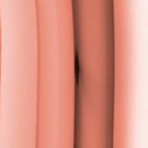 Roségold