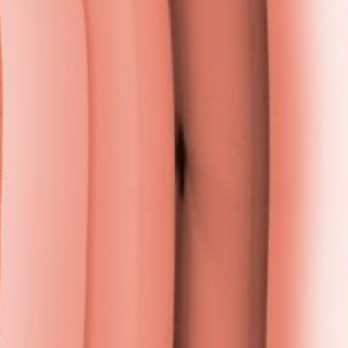 Roségold