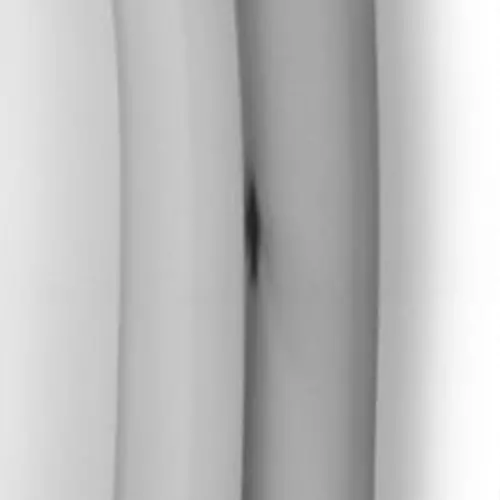 Aluminium